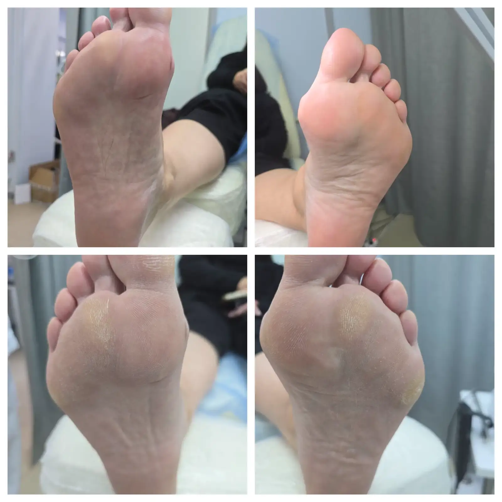 Сложные случаи