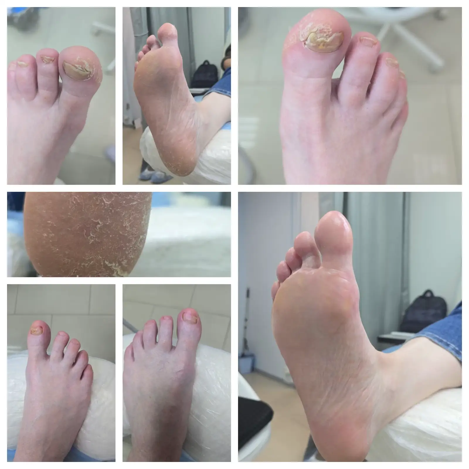 Здоровые ногти